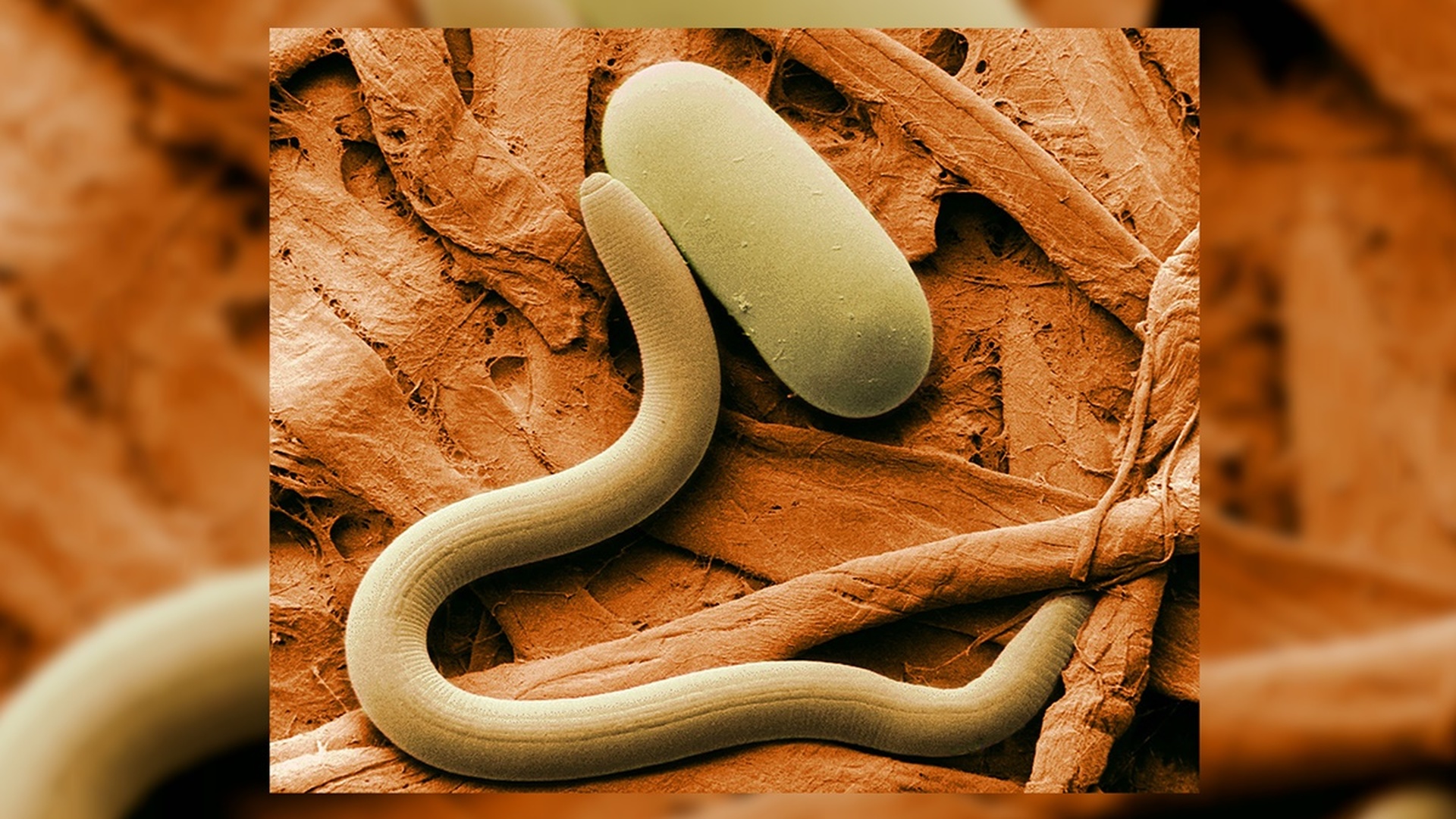 Паразитарный червяк