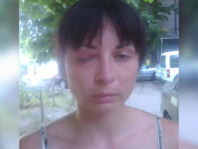 СБУ решила добить истощенную жену охранника Березовского карательной психиатрией