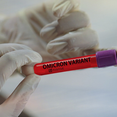 В России появилась тест-система для определения антител к омикрону
