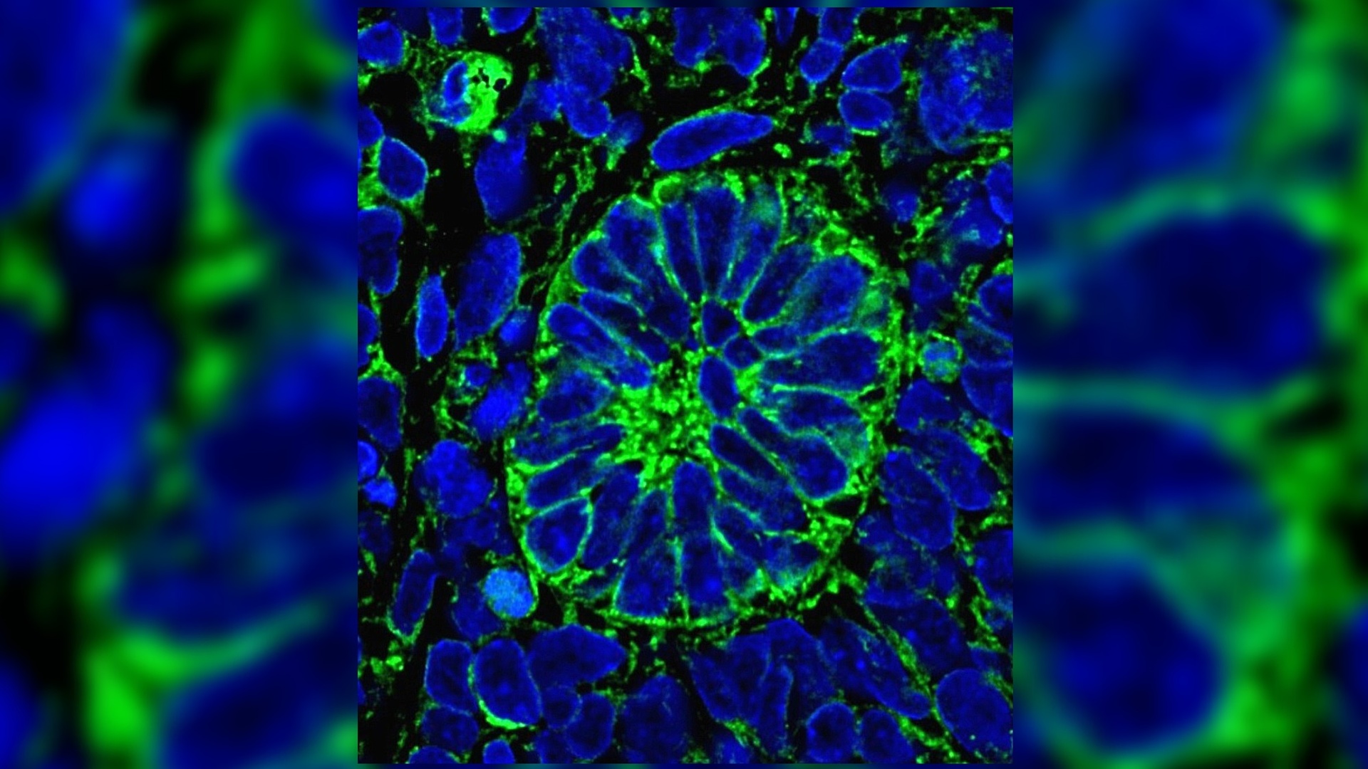 Искусственная клетка 3. Клетки. Стволовые клетки. Стволовая клетка под микроскопом. Растения под микроскопом.
