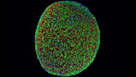 Мышечное волокно, выращенное из индуцированных плюрипотентных стволовых клеток (в разрезе). Зелёным цветом обозначаны мышечные клетки, синим √ ядра клеток, красным √ поддерживающая матрица. 