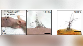 Слева волосяной фолликул на пересаженном участке кожи на теле мыши. Справа образец вне организма.