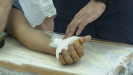 В Ростове хирурги пришили мужчине отрубленную руку