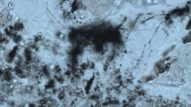 Микроскопическое изображение нитевидной окаменелости возможного древнего микроорганизма.