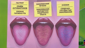 Как по виду языка определить рак и проблемы с сердцем