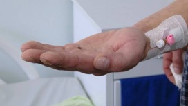 В Ижевске хирурги 7 ГКБ извлекли осколок гранаты из ноги участника СВО