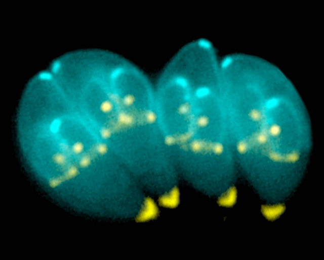 Паразит токсоплазма (Toxoplasma gondii) может довести до самоубийства владелицу пушистого мурлыкающего существа