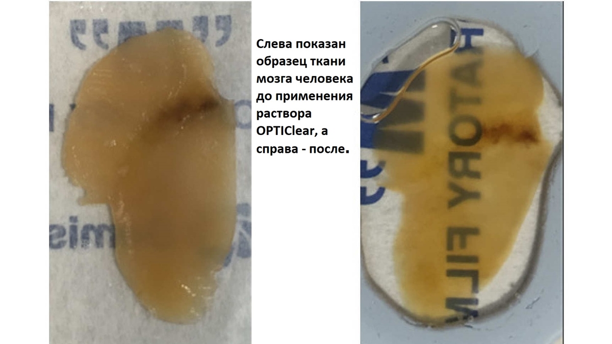 Сравнение: до и после применения раствора.