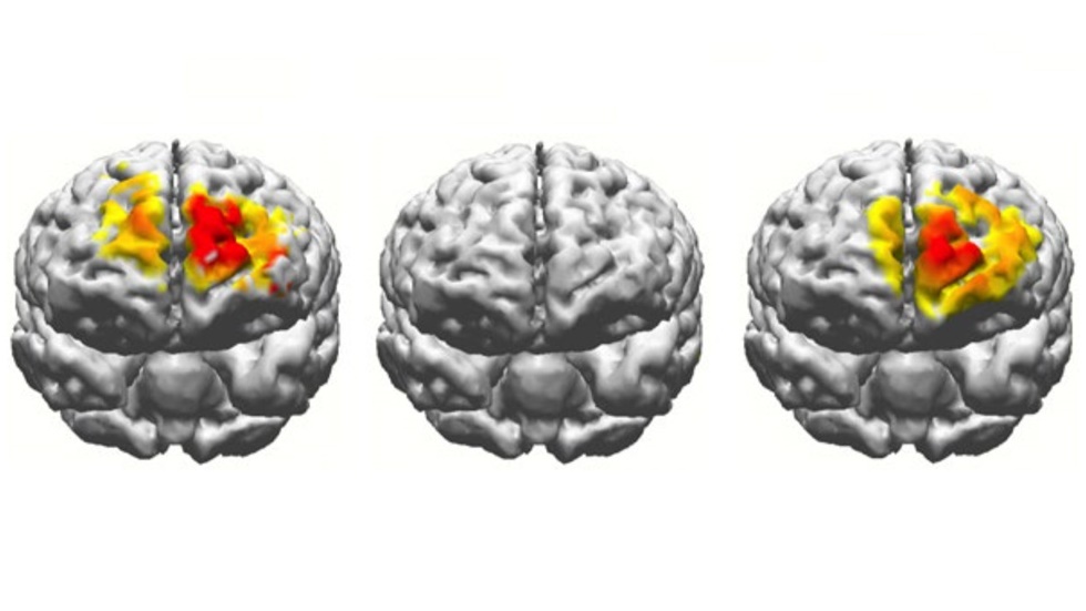 Активность мозга во время выполнения теста на рабочую память. Слева – мозг 20-летнего участника. В центре – мозг 70-летнего участника. Справа – мозг того же пожилого человека после электростимуляции.