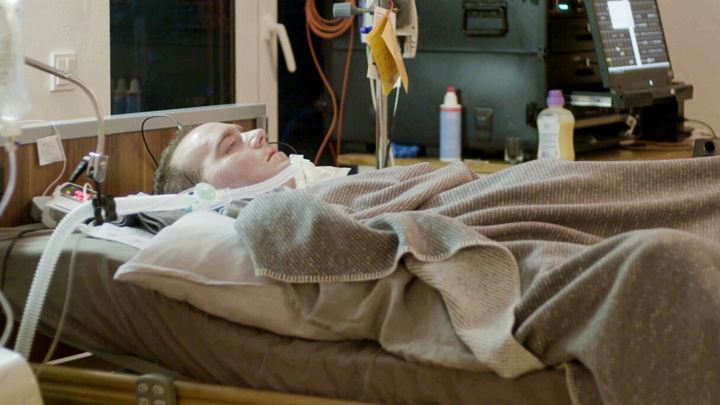 Мужчина с боковым амиотрофическим склерозом дышит с помощью аппарата ИВЛ и общается с помощью мозгового имплантата.